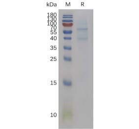 SDS-PAGE - Recombinant Mouse BMP6 Protein (6×His Tag) (A317467) - Antibodies.com