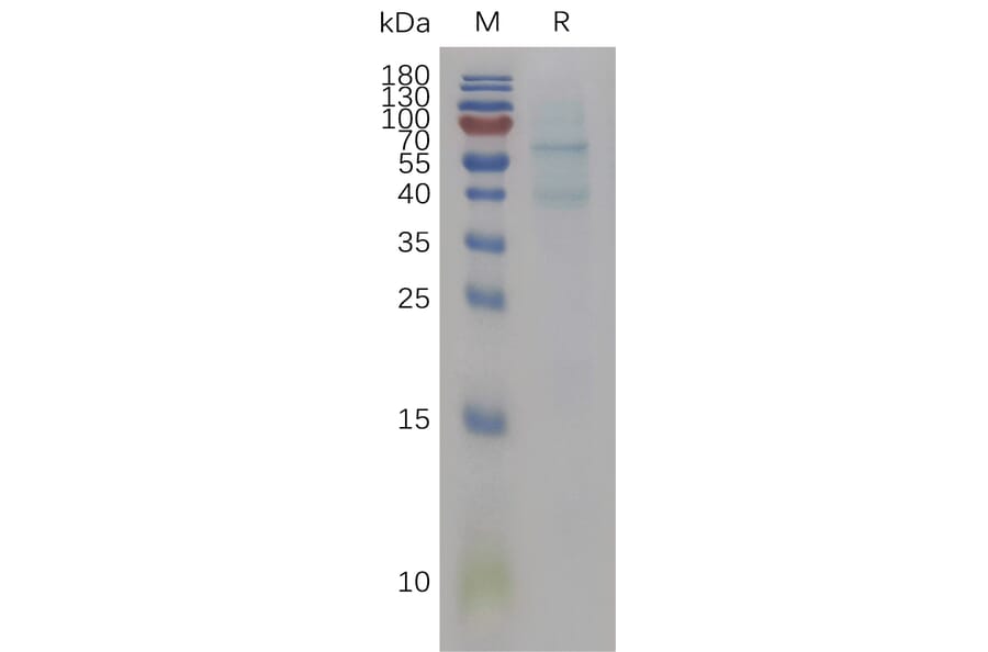 SDS-PAGE - Recombinant Mouse BMP6 Protein (6×His Tag) (A317467) - Antibodies.com