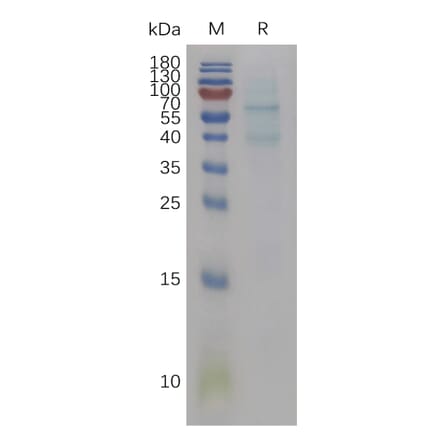 SDS-PAGE - Recombinant Mouse BMP6 Protein (6×His Tag) (A317467) - Antibodies.com
