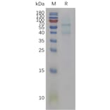 SDS-PAGE - Recombinant Mouse BMP6 Protein (6×His Tag) (A317467) - Antibodies.com