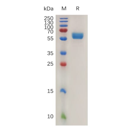 SDS-PAGE - Recombinant Mouse 4-1BBL Protein (Fc Tag) (A317469) - Antibodies.com