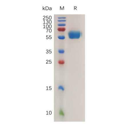 SDS-PAGE - Recombinant Mouse ROR1 Protein (6×His Tag) (A317471) - Antibodies.com