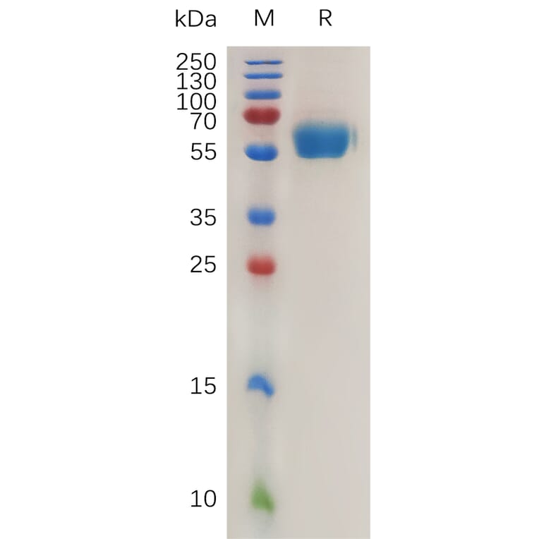 SDS-PAGE - Recombinant Mouse ROR1 Protein (6×His Tag) (A317471) - Antibodies.com