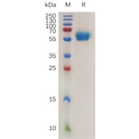 SDS-PAGE - Recombinant Mouse ROR1 Protein (6×His Tag) (A317471) - Antibodies.com