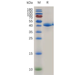SDS-PAGE - Recombinant Mouse TACI Protein (Fc Tag) (A317475) - Antibodies.com