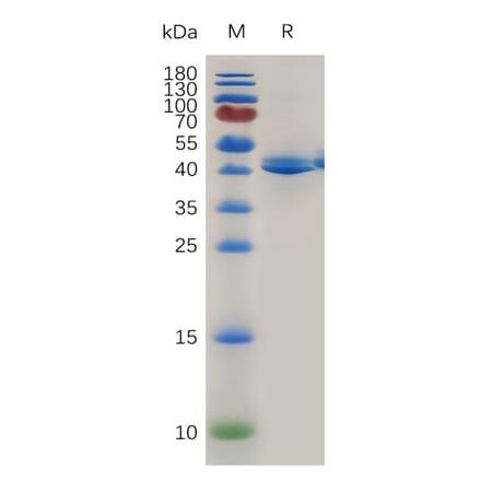 SDS-PAGE - Recombinant Mouse TACI Protein (Fc Tag) (A317475) - Antibodies.com