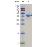 SDS-PAGE - Recombinant Mouse TACI Protein (Fc Tag) (A317475) - Antibodies.com