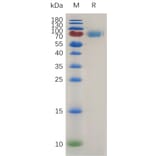 SDS-PAGE - Recombinant Mouse IL-2 Receptor alpha Protein (Fc Tag) (A317477) - Antibodies.com