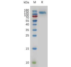 SDS-PAGE - Recombinant Mouse EGFR Protein (6×His Tag) (A317478) - Antibodies.com