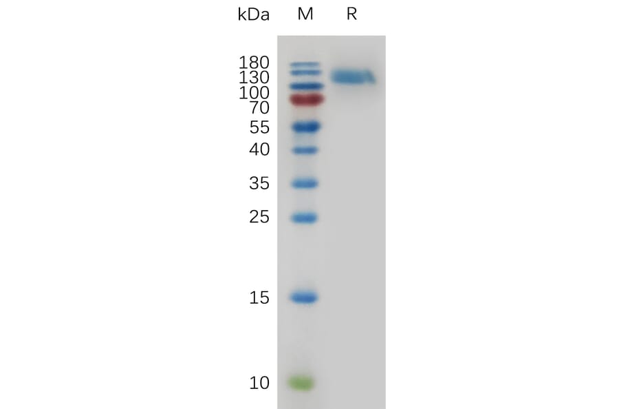 SDS-PAGE - Recombinant Mouse EGFR Protein (6×His Tag) (A317478) - Antibodies.com