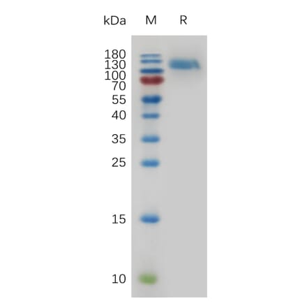 SDS-PAGE - Recombinant Mouse EGFR Protein (6×His Tag) (A317478) - Antibodies.com