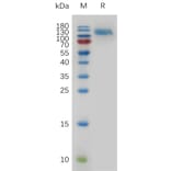 SDS-PAGE - Recombinant Mouse EGFR Protein (6×His Tag) (A317478) - Antibodies.com