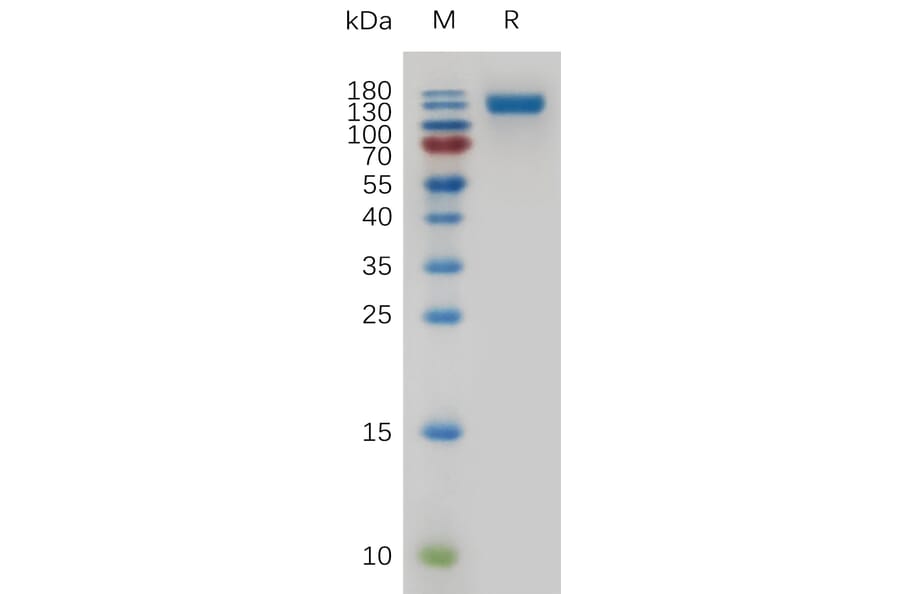 SDS-PAGE - Recombinant Mouse CD22 Protein (6×His Tag) (A317479) - Antibodies.com