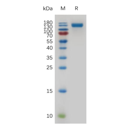 SDS-PAGE - Recombinant Mouse CD22 Protein (6×His Tag) (A317479) - Antibodies.com