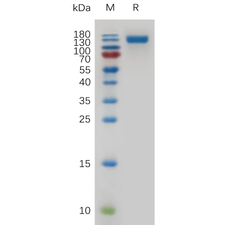 SDS-PAGE - Recombinant Mouse CD22 Protein (6×His Tag) (A317479) - Antibodies.com