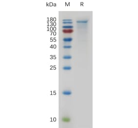 SDS-PAGE - Recombinant Mouse CEACAM5 Protein (6×His Tag) (A317480) - Antibodies.com