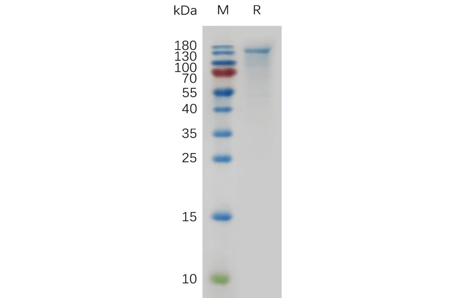 SDS-PAGE - Recombinant Mouse CEACAM5 Protein (6×His Tag) (A317480) - Antibodies.com