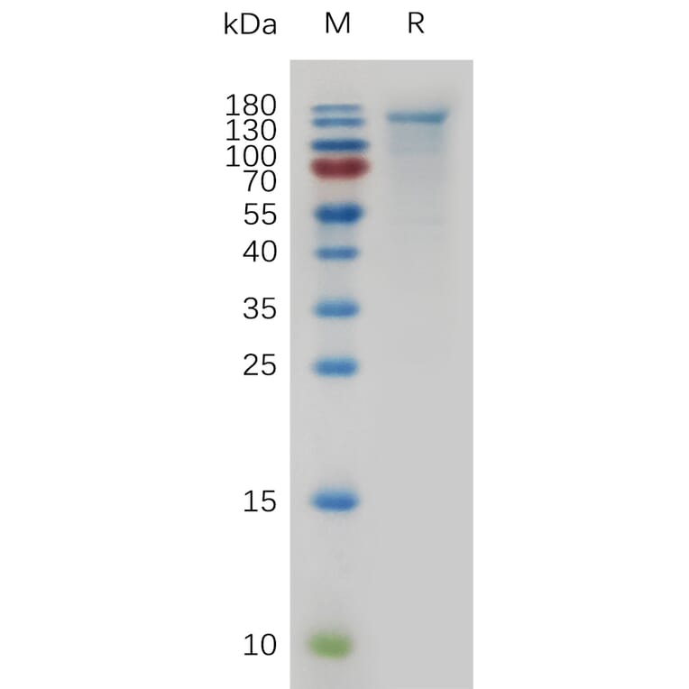 SDS-PAGE - Recombinant Mouse CEACAM5 Protein (6×His Tag) (A317480) - Antibodies.com