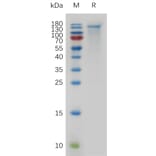 SDS-PAGE - Recombinant Mouse CEACAM5 Protein (6×His Tag) (A317480) - Antibodies.com