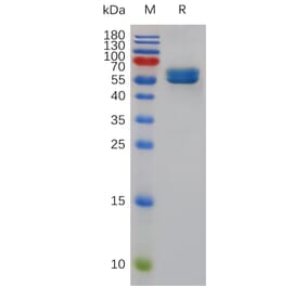 SDS-PAGE - Recombinant Mouse CD84 Protein (Fc Tag) (A317484) - Antibodies.com