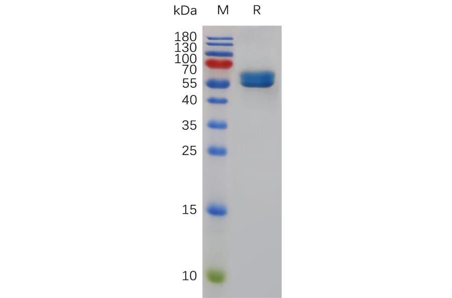 SDS-PAGE - Recombinant Mouse CD84 Protein (Fc Tag) (A317484) - Antibodies.com