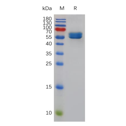SDS-PAGE - Recombinant Mouse CD84 Protein (Fc Tag) (A317484) - Antibodies.com
