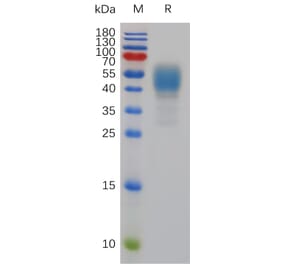 SDS-PAGE - Recombinant Mouse Cannabinoid Receptor I Protein (Fc Tag) (A317485) - Antibodies.com