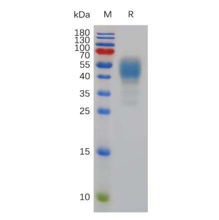 SDS-PAGE - Recombinant Mouse Cannabinoid Receptor I Protein (Fc Tag) (A317485) - Antibodies.com