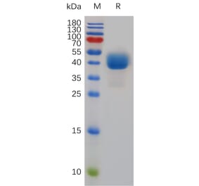 SDS-PAGE - Recombinant Mouse TIGIT Protein (Fc Tag) (A317487) - Antibodies.com