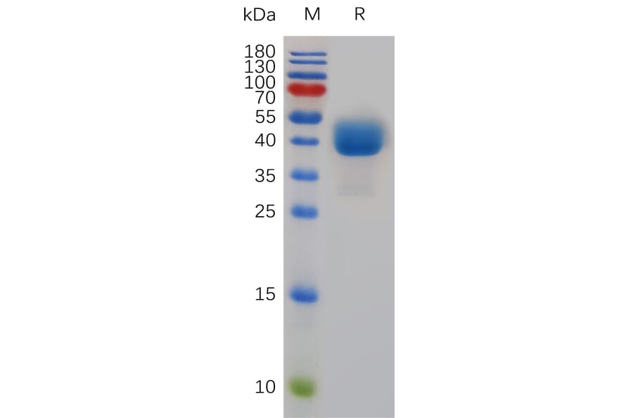 SDS-PAGE - Recombinant Mouse TIGIT Protein (Fc Tag) (A317487) - Antibodies.com