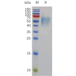 SDS-PAGE - Recombinant Mouse IL-17RA Receptor Protein (6×His Tag) (A317488) - Antibodies.com