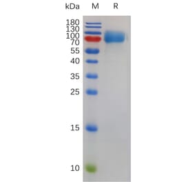 SDS-PAGE - Recombinant Mouse CSF-1-R Protein (6×His Tag) (A317489) - Antibodies.com