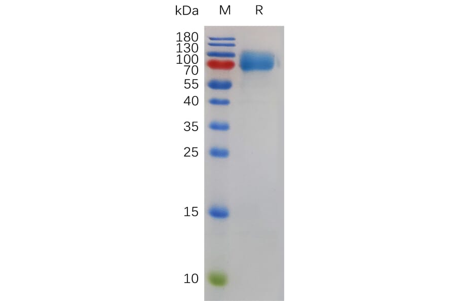 SDS-PAGE - Recombinant Mouse CSF-1-R Protein (6×His Tag) (A317489) - Antibodies.com