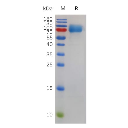 SDS-PAGE - Recombinant Mouse CSF-1-R Protein (6×His Tag) (A317489) - Antibodies.com