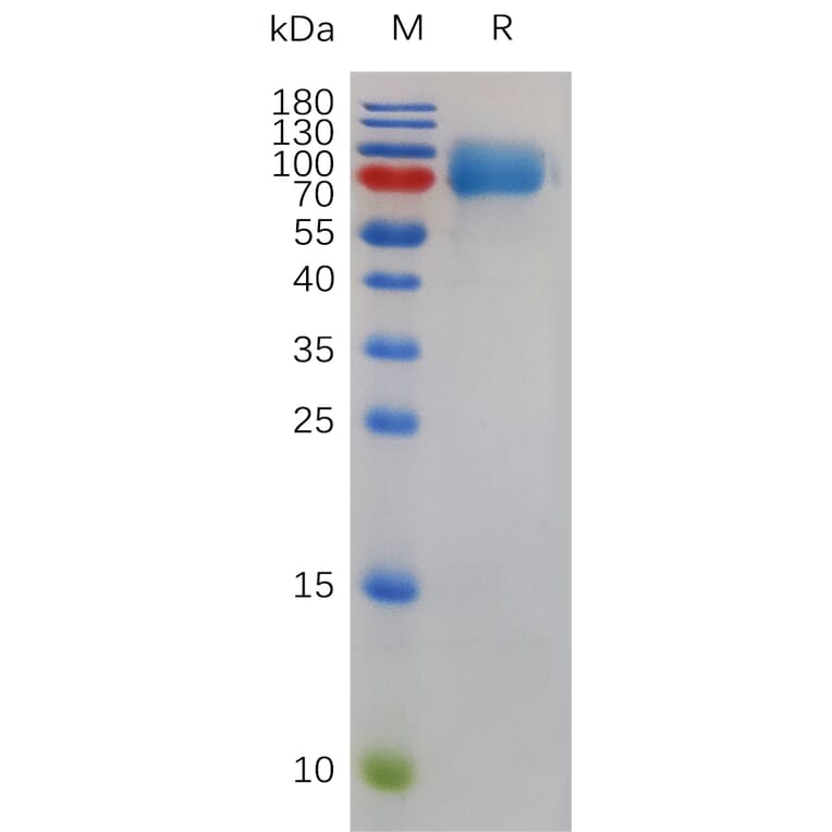 SDS-PAGE - Recombinant Mouse CSF-1-R Protein (6×His Tag) (A317489) - Antibodies.com