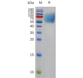 SDS-PAGE - Recombinant Mouse SIRP alpha Protein (6×His Tag) (A317490) - Antibodies.com