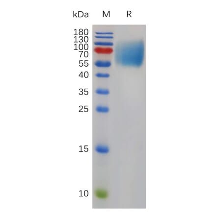 SDS-PAGE - Recombinant Mouse SIRP alpha Protein (6×His Tag) (A317490) - Antibodies.com