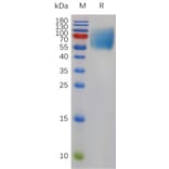SDS-PAGE - Recombinant Mouse SIRP alpha Protein (6×His Tag) (A317490) - Antibodies.com