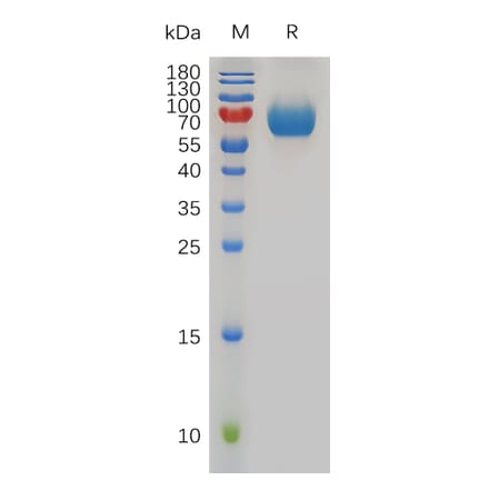 SDS-PAGE - Recombinant Mouse CD48 Protein (Fc Tag) (A317491) - Antibodies.com