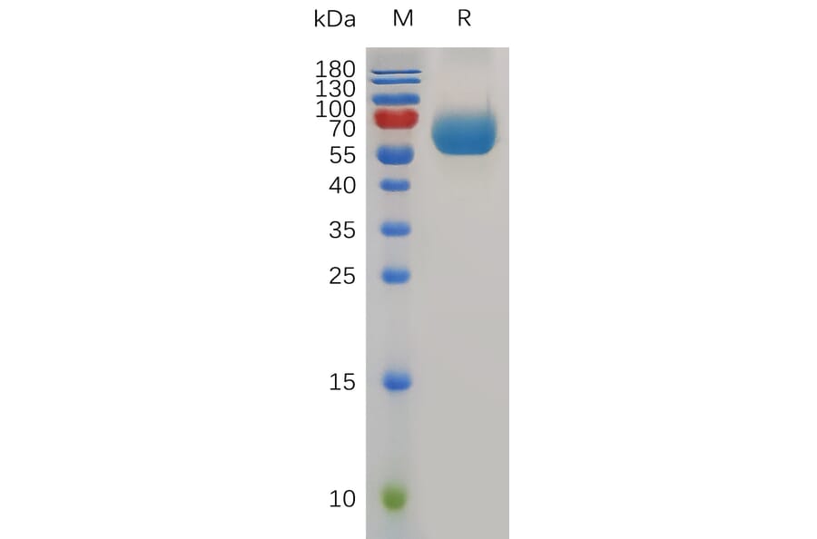 SDS-PAGE - Recombinant Mouse TIM 3 Protein (Fc Tag) (A317492) - Antibodies.com