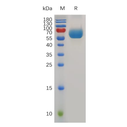 SDS-PAGE - Recombinant Mouse TIM 3 Protein (Fc Tag) (A317492) - Antibodies.com