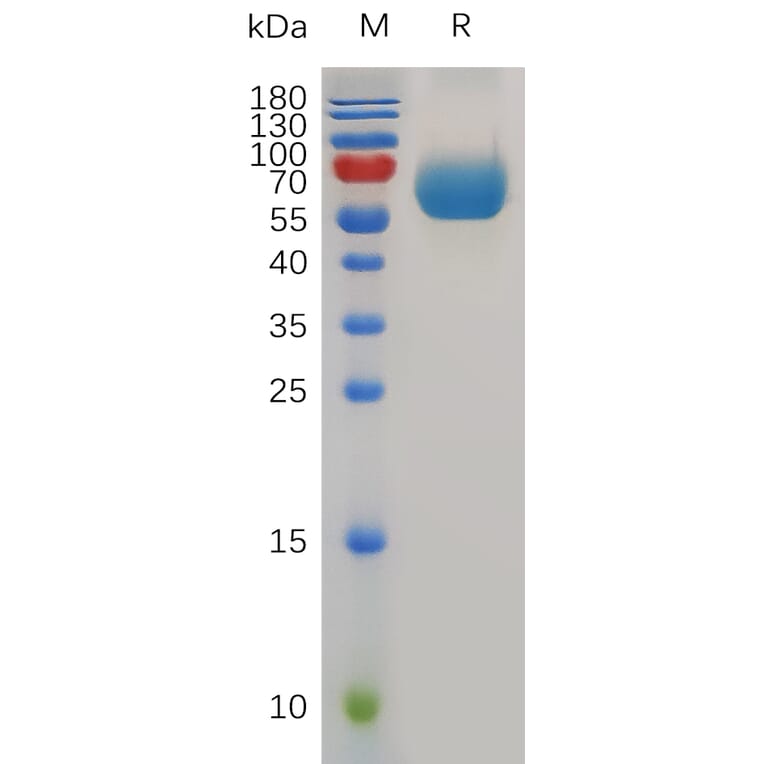 SDS-PAGE - Recombinant Mouse TIM 3 Protein (Fc Tag) (A317492) - Antibodies.com