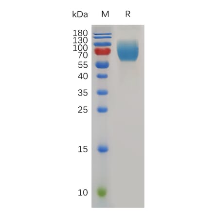 SDS-PAGE - Recombinant Mouse CD86 Protein (Fc Tag) (A317494) - Antibodies.com