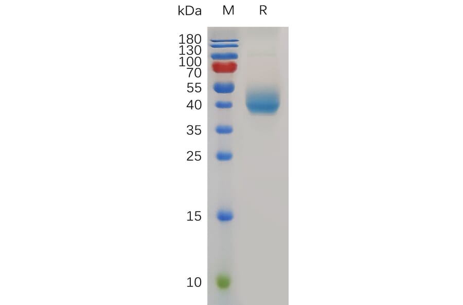 SDS-PAGE - Recombinant Mouse PSCA Protein (Fc Tag) (A317495) - Antibodies.com
