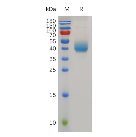 SDS-PAGE - Recombinant Mouse PSCA Protein (Fc Tag) (A317495) - Antibodies.com
