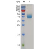 SDS-PAGE - Recombinant Mouse PSCA Protein (Fc Tag) (A317495) - Antibodies.com