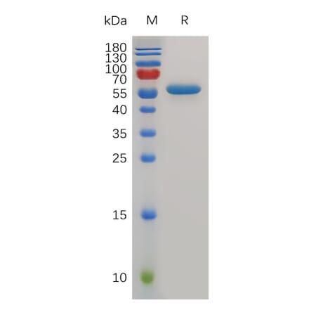 SDS-PAGE - Recombinant Mouse CD40 Protein (Fc Tag) (A317498) - Antibodies.com