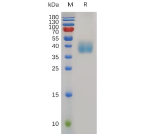 SDS-PAGE - Recombinant Mouse Mesothelin Protein (6×His Tag) (A317500) - Antibodies.com
