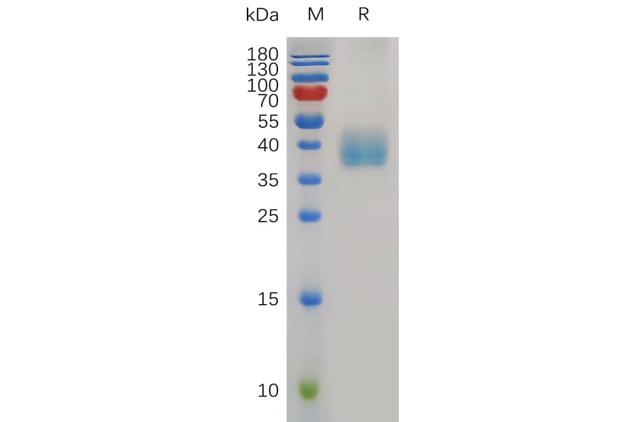 SDS-PAGE - Recombinant Mouse Mesothelin Protein (6×His Tag) (A317500) - Antibodies.com