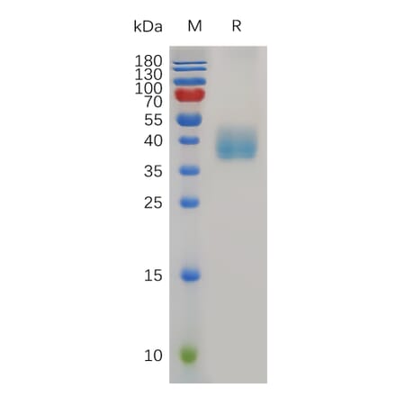 SDS-PAGE - Recombinant Mouse Mesothelin Protein (6×His Tag) (A317500) - Antibodies.com